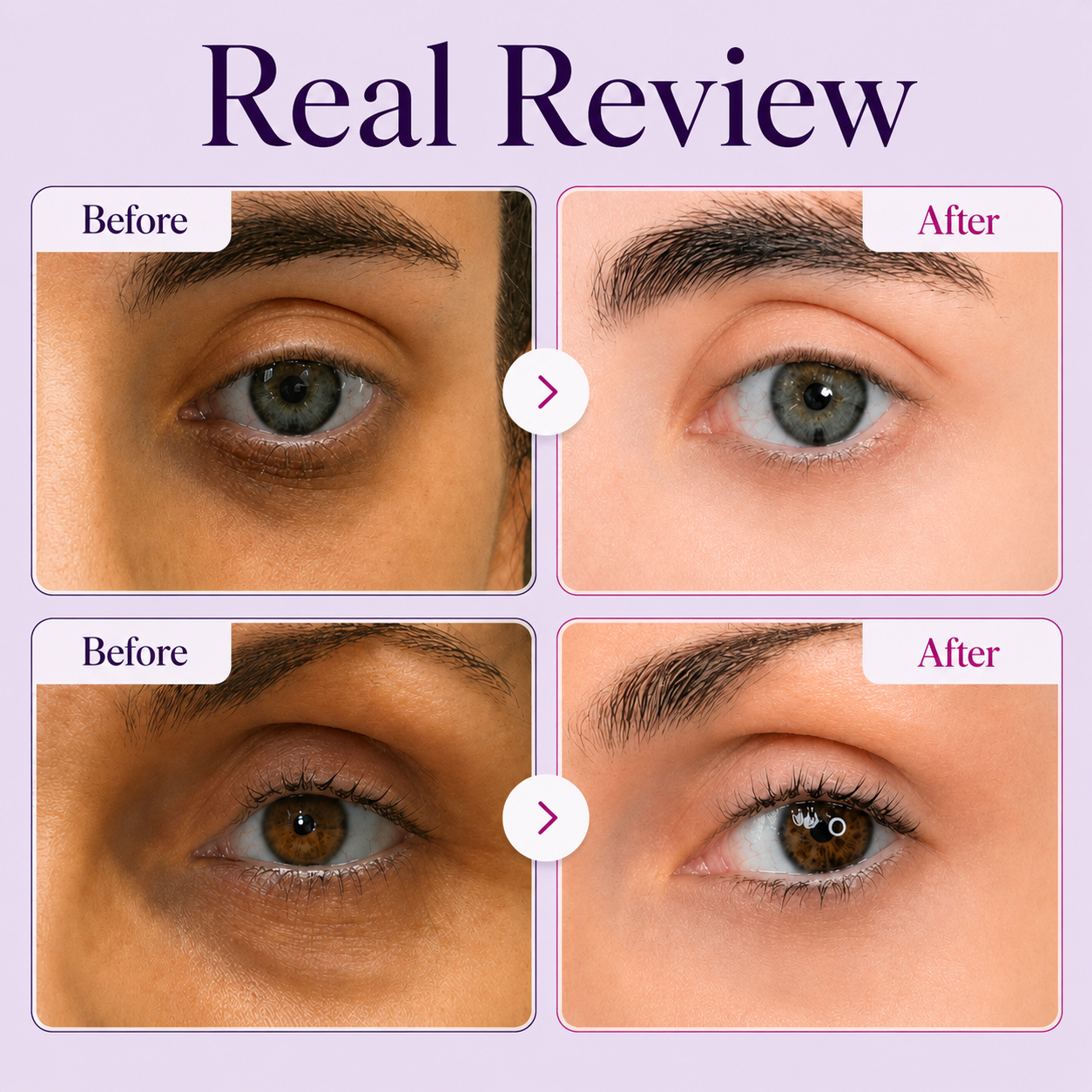LEVPLUS™ Calcium Dark Spot Eye Cream