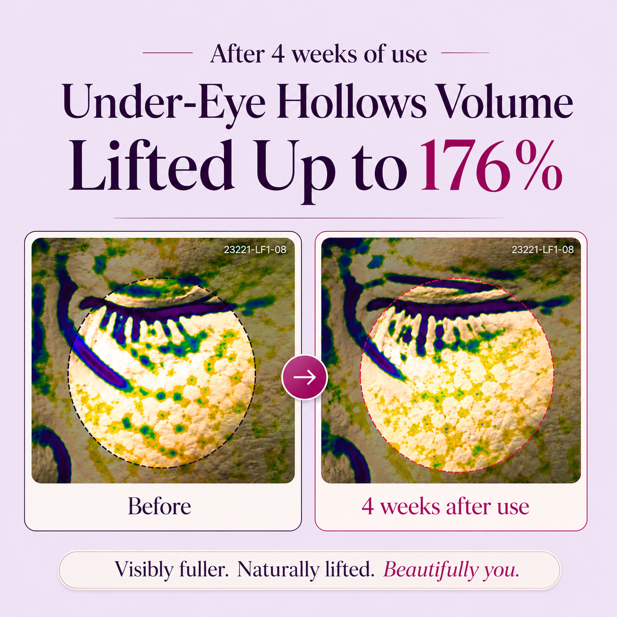LEVPLUS™ Calcium Dark Spot Eye Cream