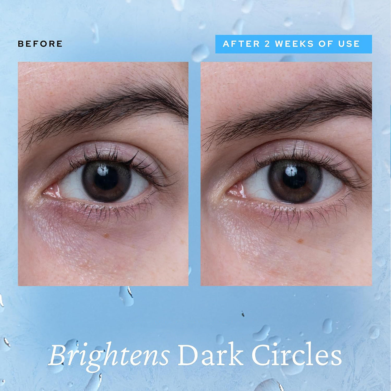 Cooling Eye Gel with Ceramic Tip | Caffeine, Niacinamide & Hyaluronic Acid Depuff Under Eye Treatment