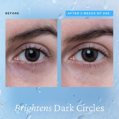 Cooling Eye Gel with Ceramic Tip | Caffeine, Niacinamide & Hyaluronic Acid Depuff Under Eye Treatment