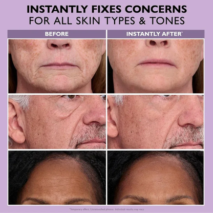 Reverse-Aging Eye Tightener
