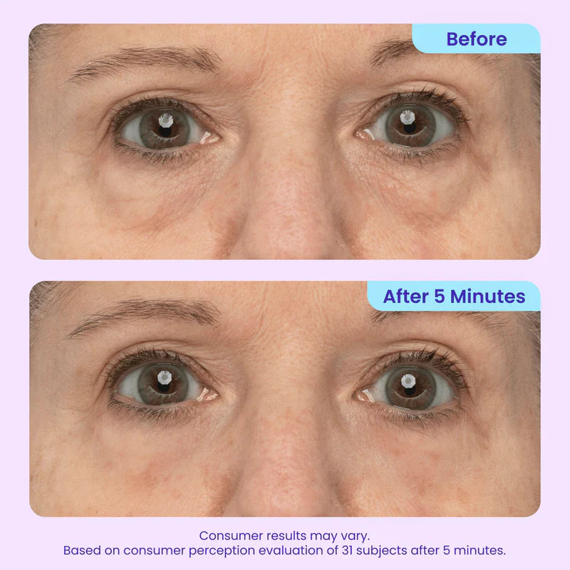 Eye Bag Instant Eraser, Tightens, Firms, & Blurs Wrinkles🔥