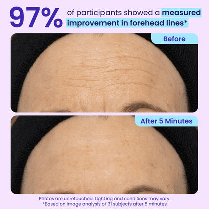 Eye Bag Instant Eraser, Tightens, Firms, & Blurs Wrinkles🔥