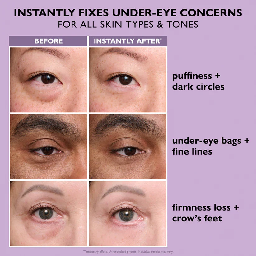 Eye Bag Instant Eraser, Tightens, Firms, & Blurs Wrinkles🔥