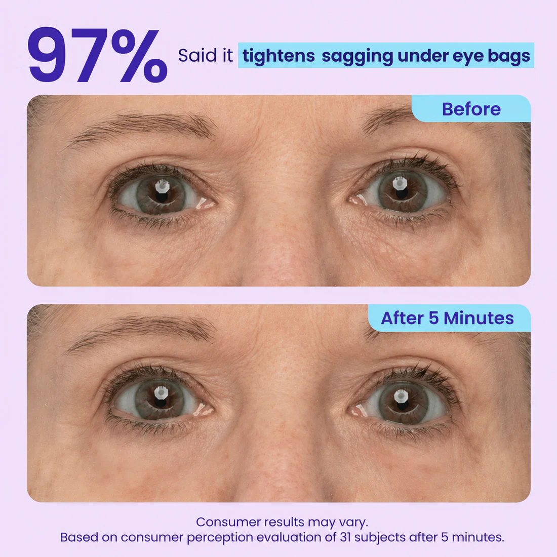 LEVPLUS™ Instant Eye Tightener - Tightens, Firms, & Blurs Wrinkles
