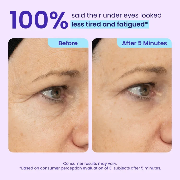 LEVPLUS™ Instant Eye Tightener - Tightens, Firms, & Blurs Wrinkles