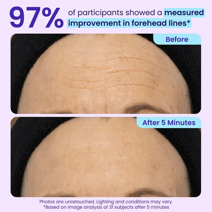 LEVPLUS™ Instant Eye Tightener - Tightens, Firms, & Blurs Wrinkles