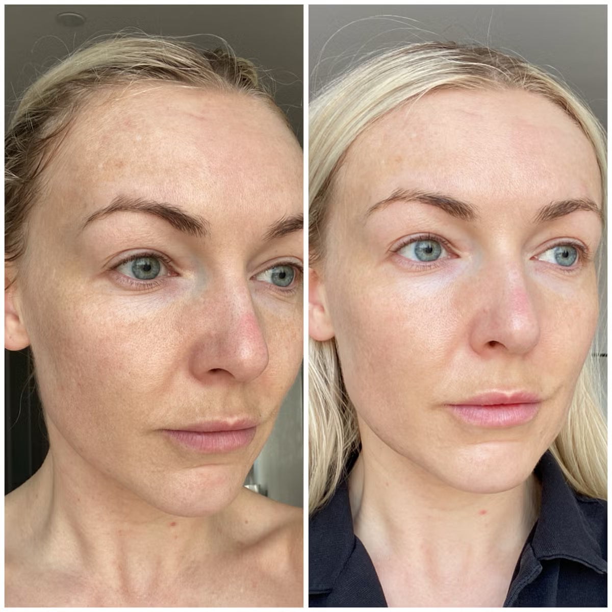 LEVPLUS Plump Serum - 3% 8D Hyaluronic Acid + PDRN for Deep Hydration & Firming